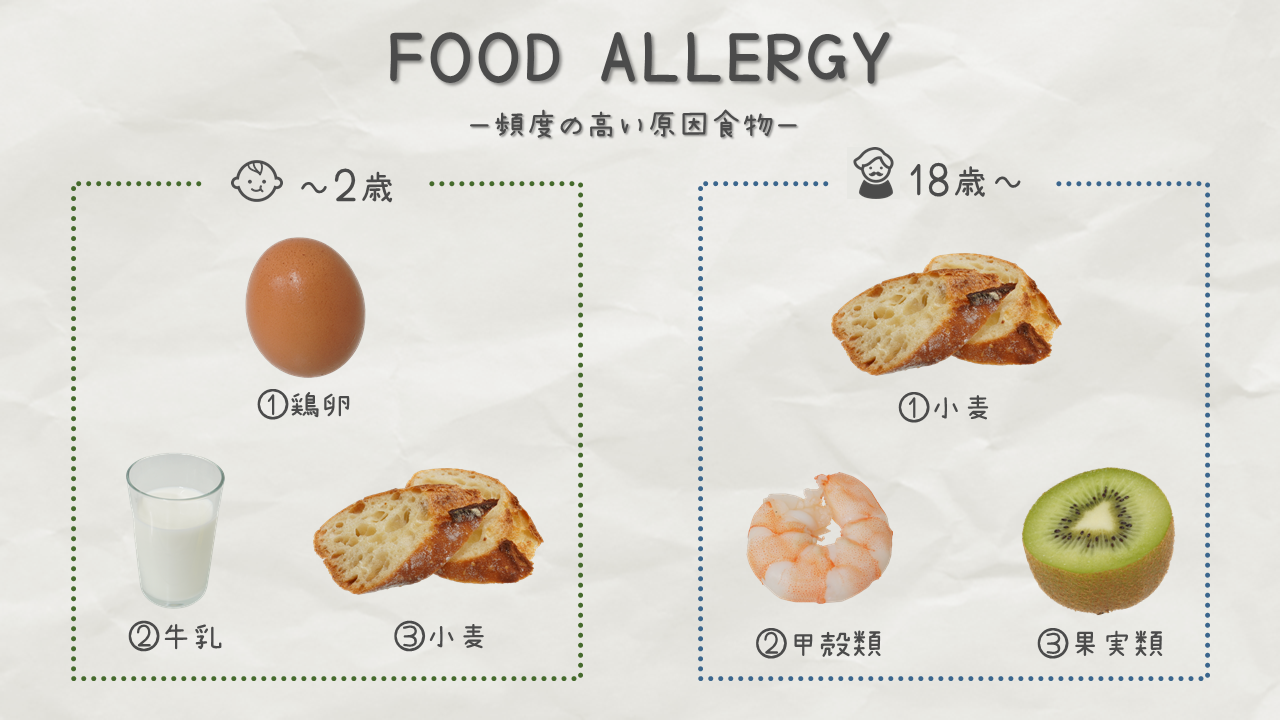 食物アレルギーの中でも頻度の高い原因食物｜商用可フリー画像・背景透過
